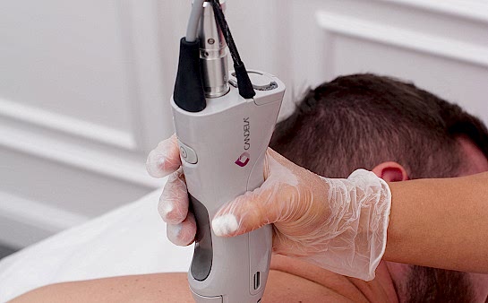 Эпиляция спины для мужчин