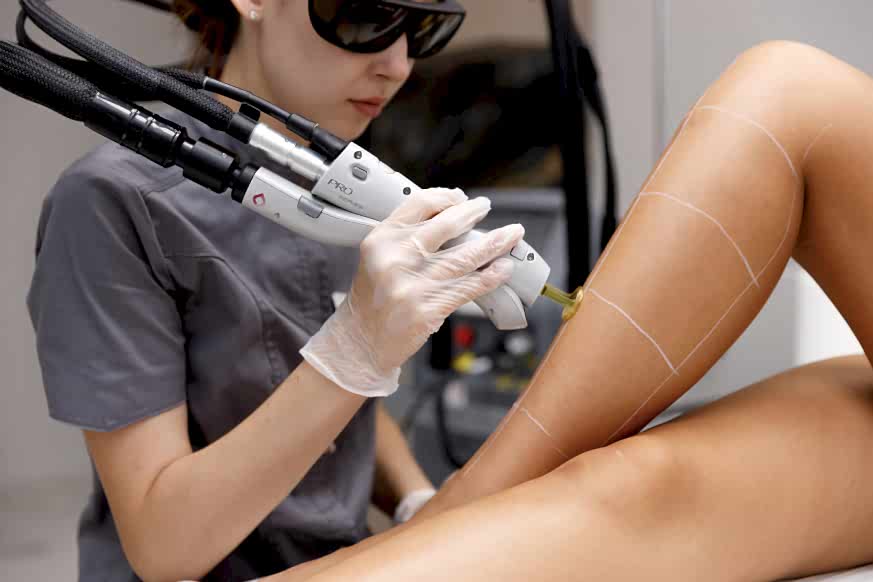 Сколько процедур нужно для полного удаления волос с помощью лазерной эпиляции?