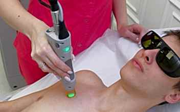 Лазерная эпиляция груди для мужчин