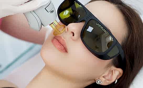 Лазерная эпиляция лица полностью