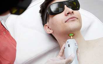 Лазерная эпиляция передней зоны шеи для мужчин