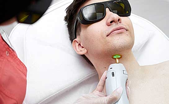 Лазерная эпиляция передней зоны шеи для мужчин