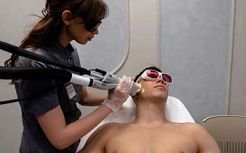 Лазерная эпиляция бороды для мужчин