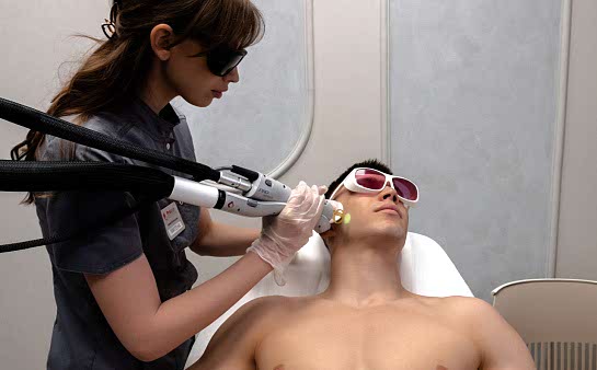 Лазерная эпиляция бороды для мужчин