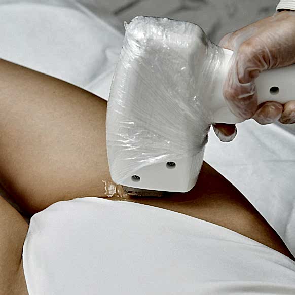 Подготовка к лазерной эпиляции: что нужно знать