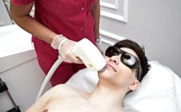 Лазерная эпиляция подбородка для мужчин