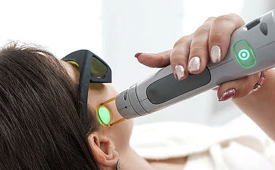 Лазерная эпиляция бакенбард