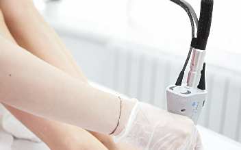 Лазерная эпиляция голени